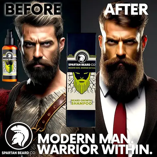 𝗦𝗣𝗔𝗥𝗧𝗔𝗡 𝗕𝗘𝗔𝗥𝗗™ Shampoo (80% OFF - Primo Ordine)